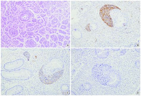 Expression Of Lineage Specific Transcription Factor Pituitary Specific