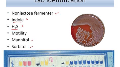 Lecture 10 Enterobacteriaceae Salmonella YouTube