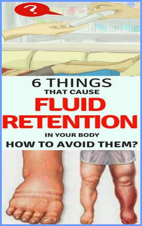 6 Things That Cause Fluid Retention in Your Body and How to Avoid Them ...