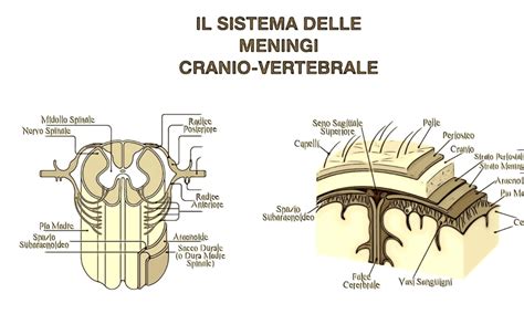 Aracnoidite Dott Ambrogio Peretti Roma