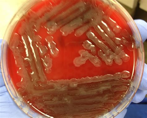 Mucoid Bacillus Microbiology Medical Laboratory Science Laboratory