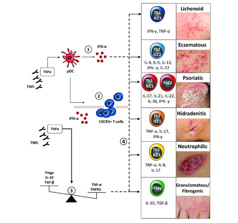 Classification And Pathogenesis Of Cutaneous Paradoxical Reactions To Download Scientific