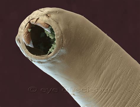 Sem Parasitic Roundworm Ancylostoma Ceylanicum Microscopy