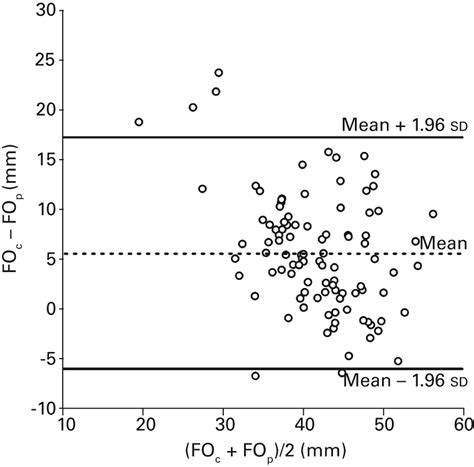 Femoral Offset Is Underestimated On Anteroposterior Radiographs Of The