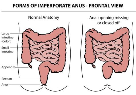 Photos Of Anus Telegraph