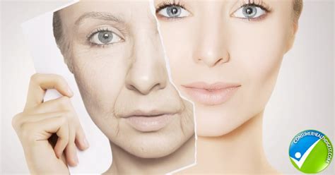 Skin Aging Process - Its Causes, Signs & Treatment