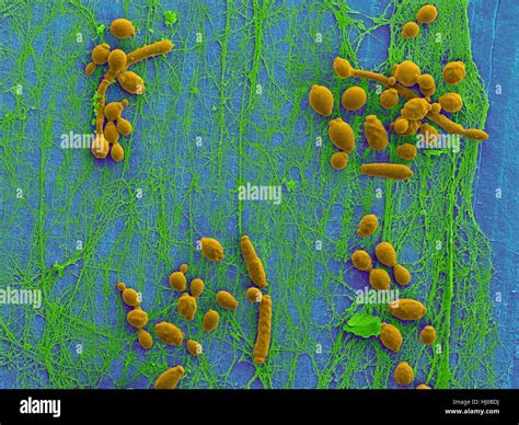 Candida Albicans Hi Res Stock Photography And Images Alamy