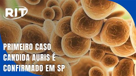 Primeiro caso do superfungo Candida auris é confirmado em SP YouTube