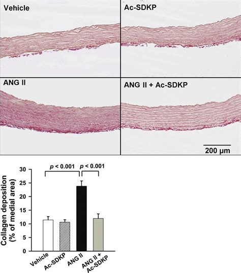 Effect Of Ac Sdkp On Ang Ii Induced Collagen Deposition In The Aortic