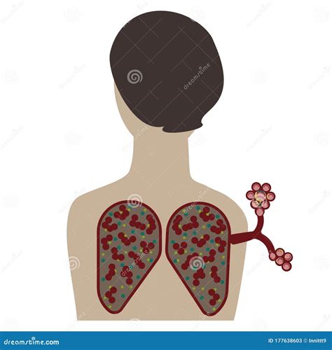 A Human Silhouette Depicting The Respiratory System Lungs Showing