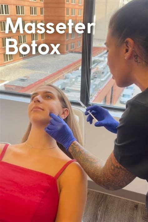 Masseter Botox Video