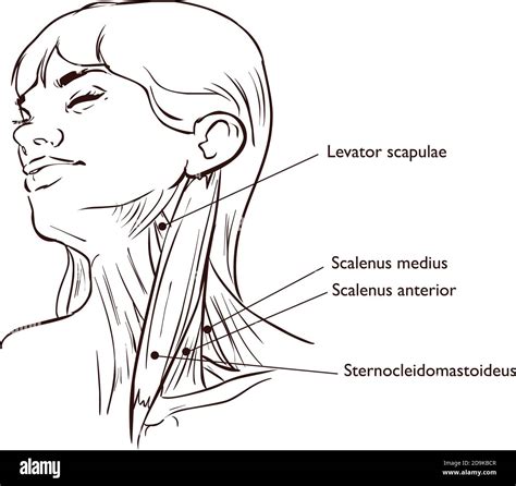 Vector Illustration Of Neck Muscles Anatomy Stock Vector Image Art