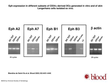 Human Dendritic Cells Express Neuronal Eph Receptor Tyrosine Kinases