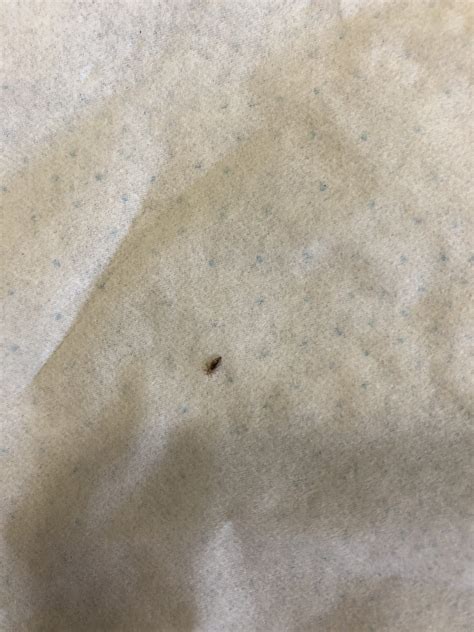 The Truth About Lice