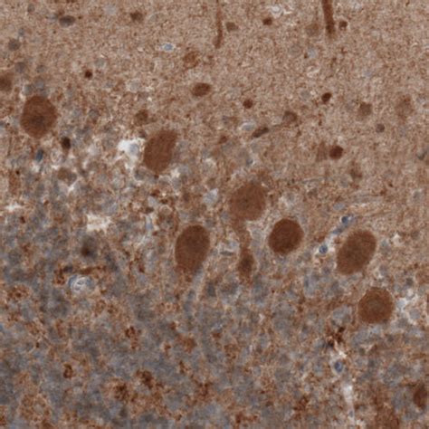 Anti Uchl Antibody Ul Igg Clone Cl Unconjugated Mouse