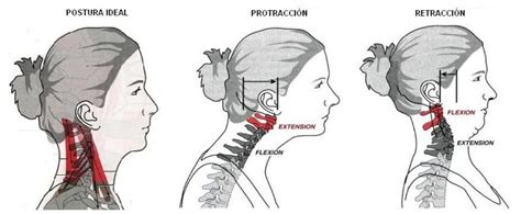 Columna Cervical Estr S Y Control Postural Medspine Es