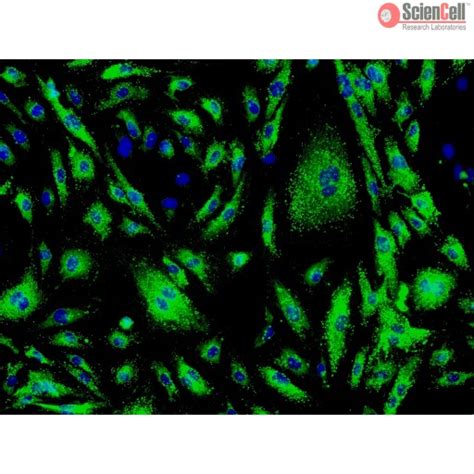 Human Cardiac Microvascular Endothelial Cells HCMEC