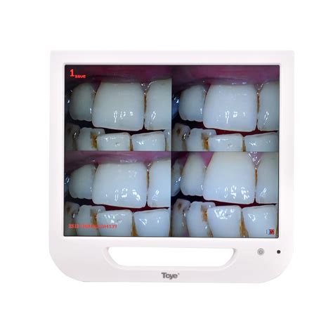 High Definition 17 Inch Monitor Dental Endoscope Integrated Intraoral