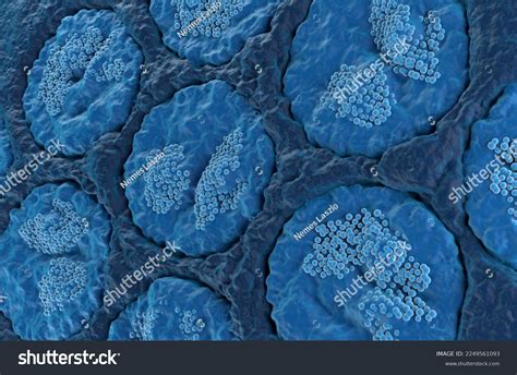 21 Tumors Jaws 3d Images Stock Photos Vectors Shutterstock