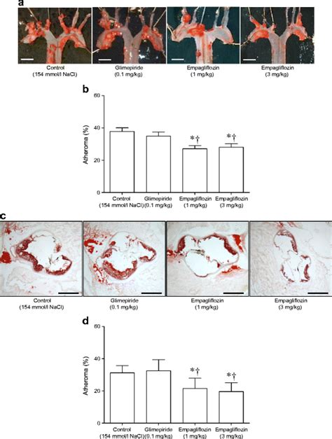 Atheroma burden in the aorta of ApoE−/− mice (n = 12 per group) after ...