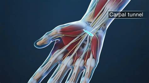 Carpal Tunnel Syndrome Causes Symptoms Diagnosis And Treatment