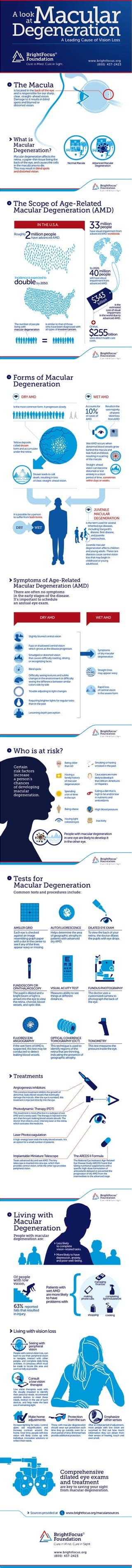 A Look At Macular Degeneration - Infographic | PDF