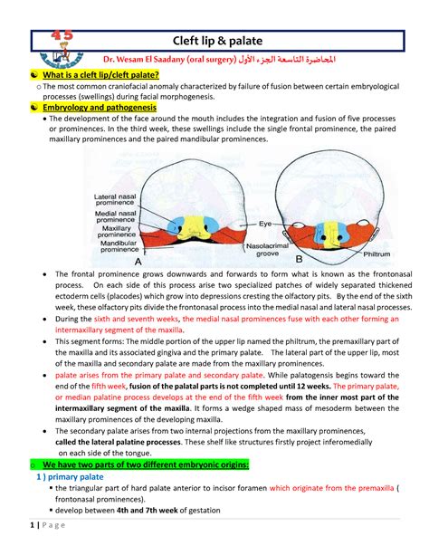 Cleft Lip Palate Part Cleft Lip Palate Dr Wesam El Saadany