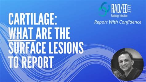 CARTILAGE DAMAGE MRI KNEE : SURFACE LESIONS (VIDEO) - Radedasia