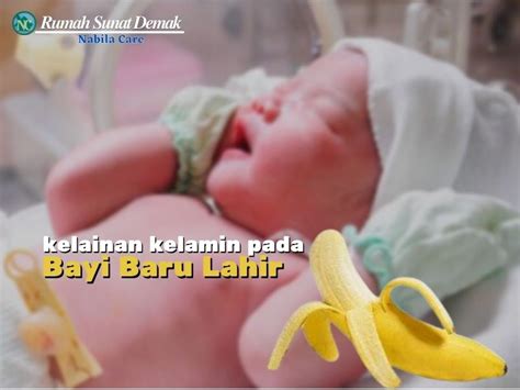 Kelainan Kelamin Pada Bayi Baru Lahir Rumah Sunat Demak