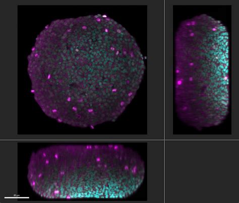 Hela Cell Spheroid Labeled By Dapi Cyan Cell Nuclei And