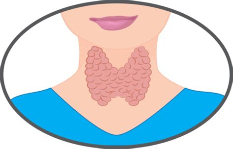 Thyroid Disease Endocrine Disfunction Vector Illustration Thyroid Gland