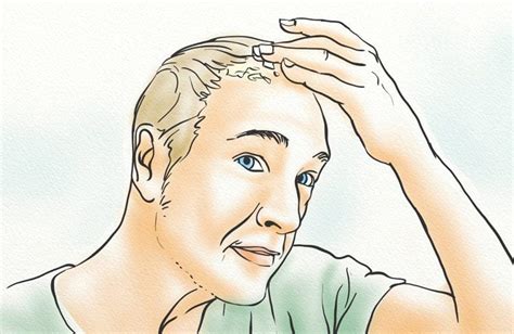 Itchy Scalp Hair Loss Causes And Treatments Hairguard