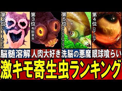 【閲覧注意】 不快を極めた最悪の寄生虫 Top10【ゆっくり解説】【総集編】 どうぶつのひきこ森 ゆっくり解説｜youtubeランキング