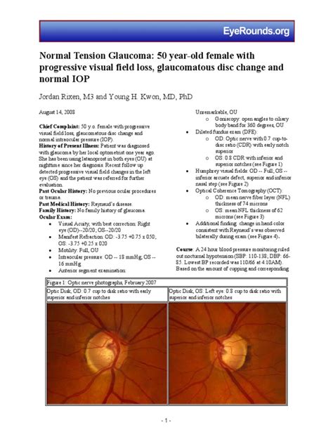 86 Normal Low Tension Glaucoma | Glaucoma | Human Eye