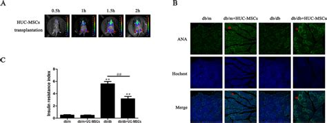 Huc Msc Transplantation Ameliorates Ir In The Skeletal Muscle Of Db Db