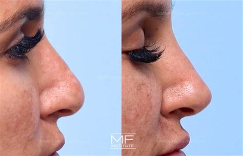 How To Make Your Nose Look Smaller Without Makeup