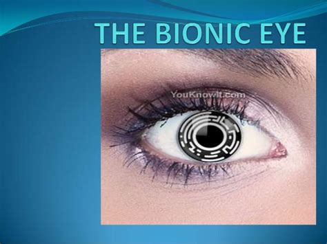 The bionic eye