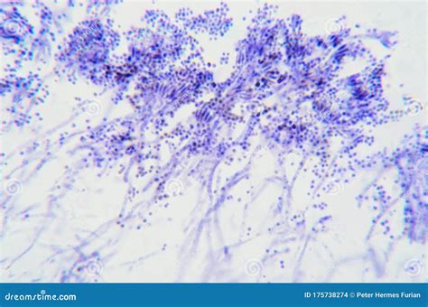 Penicillium Branches Ascomycetous Fungi Under The Microscope Stock