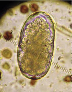 Clin Path Lab Parasites Flashcards Quizlet