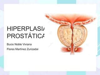 Hiperplasia Prostatica Ppt