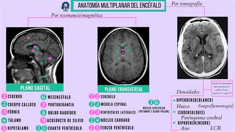 Anatomía Multiplanar Del Encéfalo Anatomía Salud Udocz