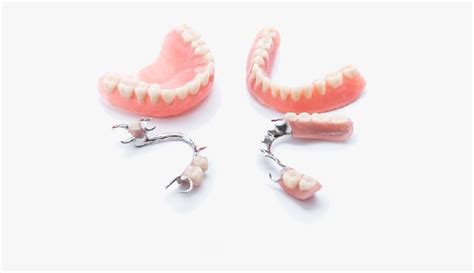 Partial-dentures - Types Of Dentures, HD Png Download - kindpng