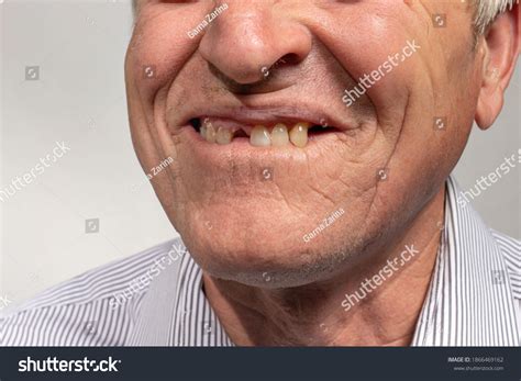 Toothless Smile Old European Man On Stock Photo 1866469162 Shutterstock