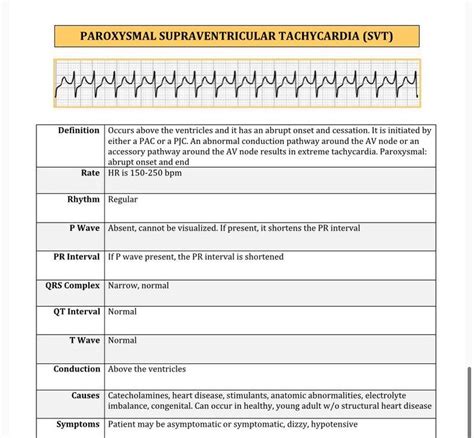 Cardiac Rhythm And Dysrhythmias Cheat Sheet 19 Pages Long Etsy