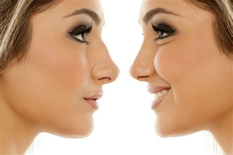 Liquid Rhinoplasty Nose Straightening Your Cosmetic Clinic