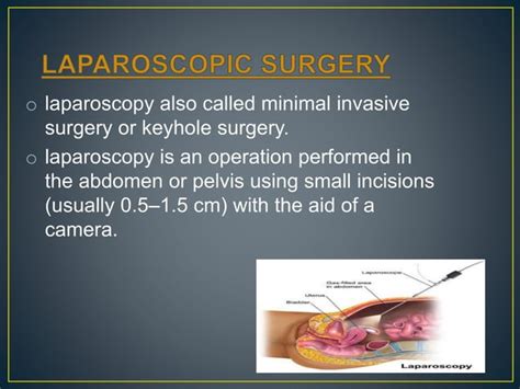 Laparoscopic Instruments Ppt