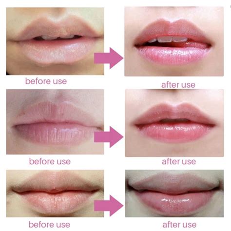 Ways Of Having Pink Lips Naturally Lipstutorial Org