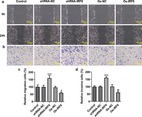 Overexpression Of Irf Inhibits The Invasion And Migration Of Ccrcc