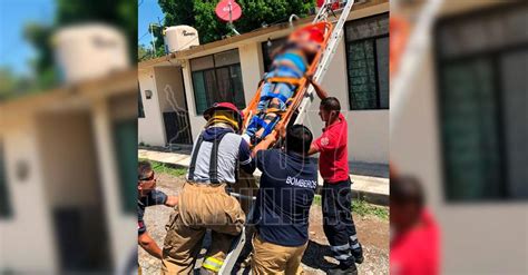 Hoy Tamaulipas Tamaulipas Se Fractura Una Pierna Al Caer De Escalera