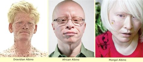 Phenotype Makes Race Do Tell Albino You Are So Beautiful To Me